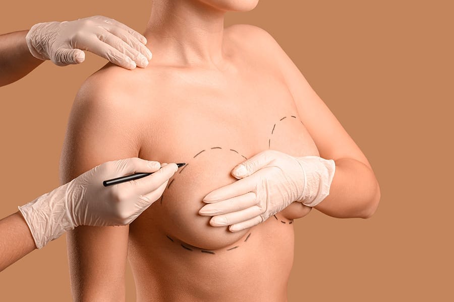 lifting mammaire cicatrices dr henri derhy chirurgien esthetique specialiste chirurgie plastique reconstructrice paris