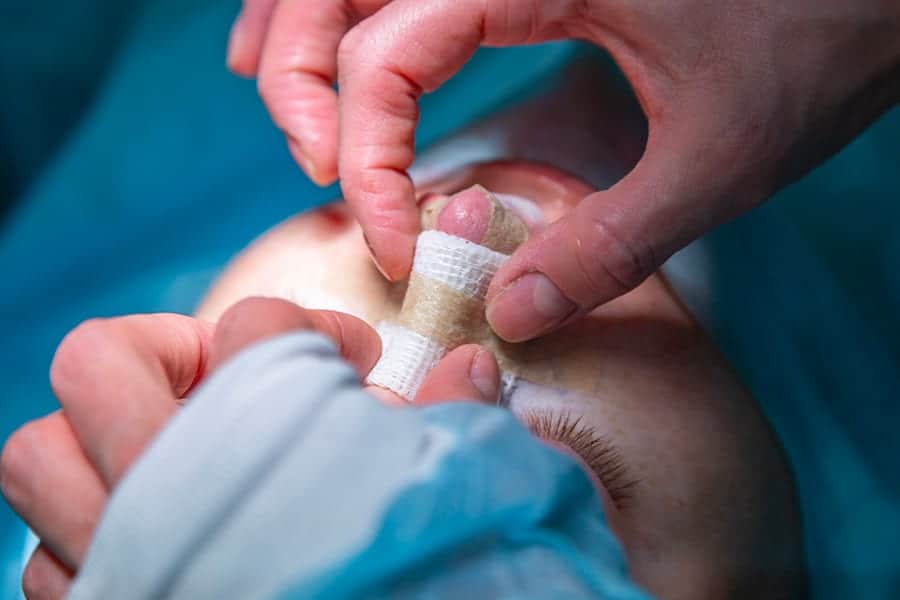 narinoplastie dr henri derhy chirurgien esthetique specialiste chirurgie plastique reconstructrice paris