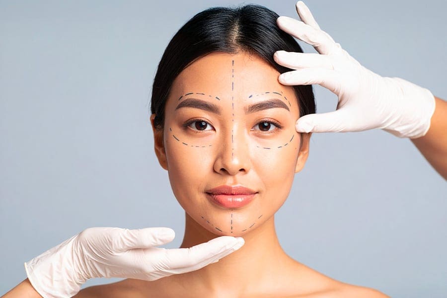 lifting visage avant apres dr henri derhy chirurgien esthetique specialiste chirurgie plastique reconstructrice paris