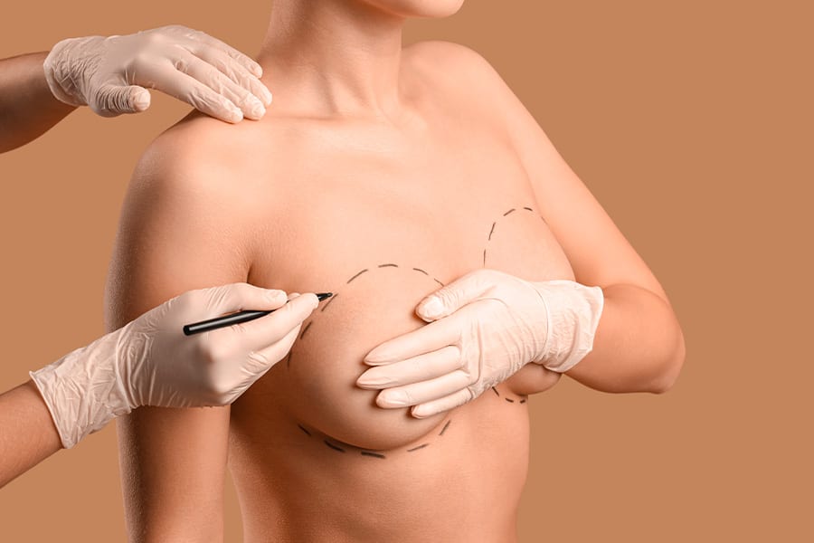 augmentation protheses mammaires lipofilling dr henri derhy chirurgien esthetique specialiste chirurgie plastique reconstructrice paris