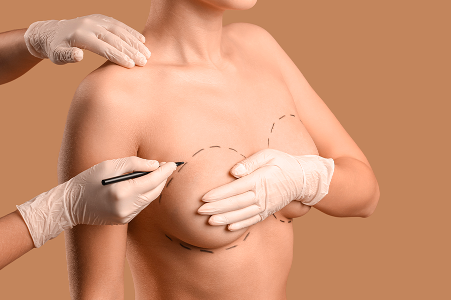 augmentation protheses mammaires lipofilling dr henri derhy chirurgien esthetique specialiste chirurgie plastique reconstructrice paris augmentation protheses mammaires lipofilling dr henri derhy chirurgien esthetique specialiste chirurgie plastique reconstructrice paris