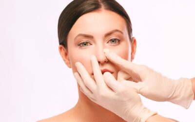 Rhinoplastie de pointe : affiner et sculpter le bas du nez avec précision