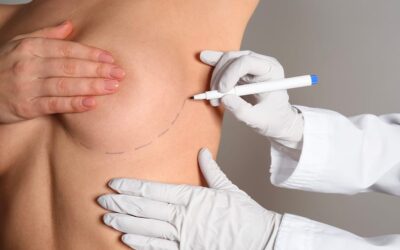 Lifting mammaire : redonner forme et jeunesse à une poitrine qui s&rsquo;est relâchée