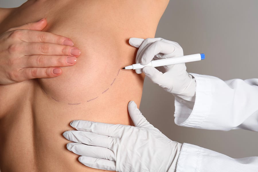 lifting mammaire cure de ptose chirurgie des seins dr henri derhy chirurgien esthetique specialiste chirurgie plastique reconstructrice paris