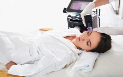 Morpheus 8 : la radiofréquence fractionnée pour raffermir la peau sans chirurgie